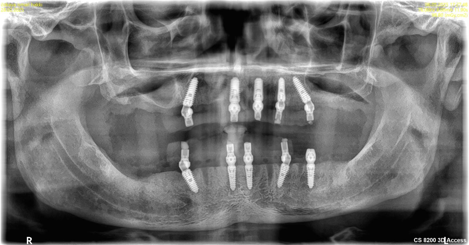 Oral- und Kieferchirurgie